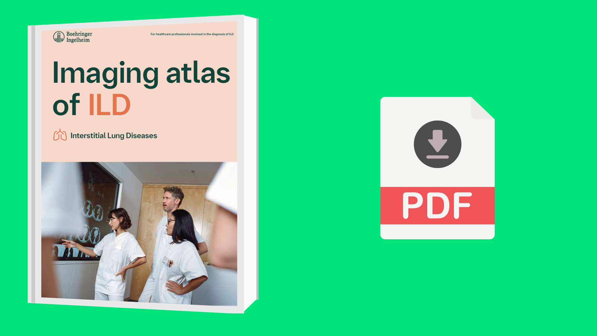 ΑΤΛΑΝΤΑΣ ΑΠΕΙΚΟΝΙΣΗΣ ΣTΙΣ ΙLDs