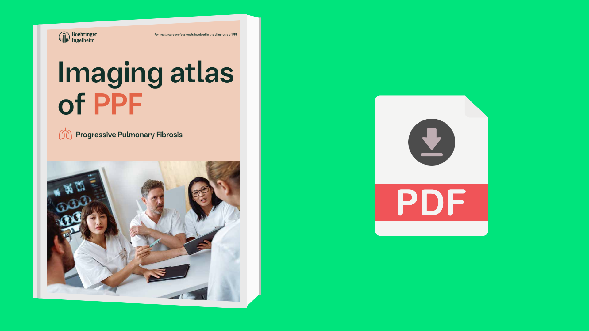 ΑΤΛΑΝΤΑΣ ΑΠΕΙΚΟΝΙΣΗΣ ΣΤΗΝ PPF