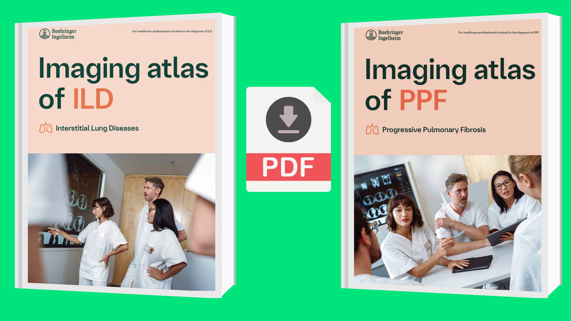 ΑΤΛΑΝΤΑΣ ΑΠΕΙΚΟΝΙΣΗΣ ΑΞΟΝΙΚΗΣ ΤΟΜΟΓΡΑΦΙΑΣ ΘΩΡΑΚΟΣ